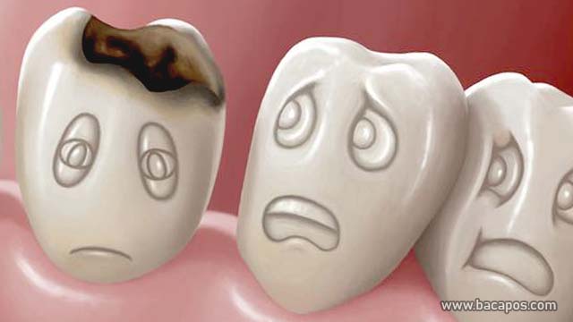 Efek samping coklat Merusak gigi dampak negatif